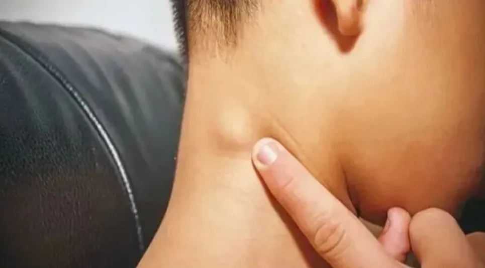 5岁男孩确诊已是晚期, 且转动! 别冷漠身上这种“小疙瘩”